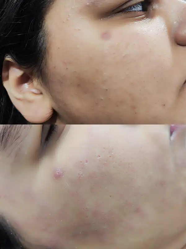 خدمات پوست - اپلاسیون - راضیه الهامیان