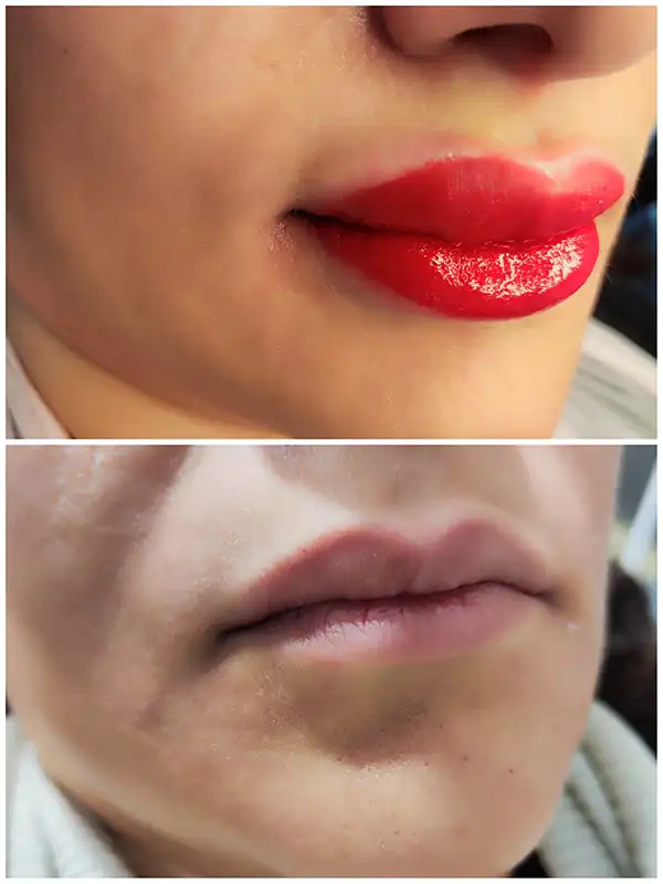 شیدلینگ لب - راضیه الهامیان