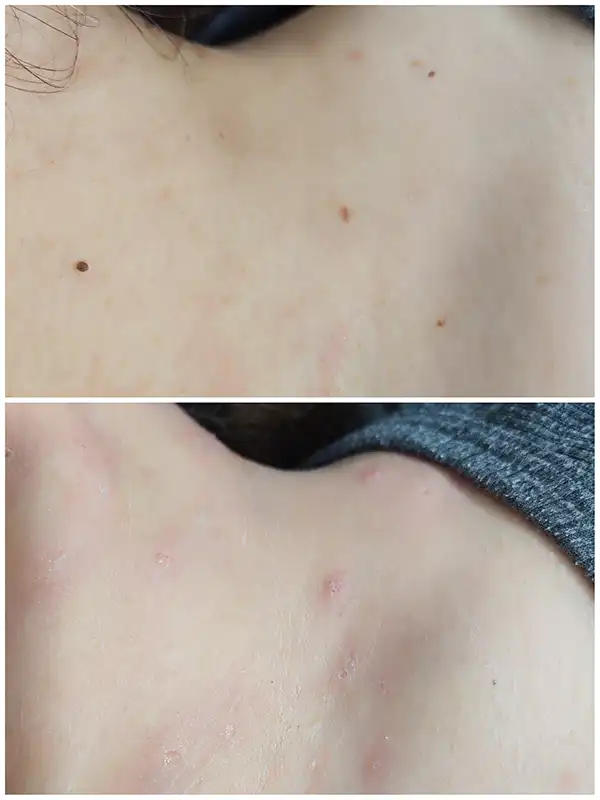 خدمات پوست - اپلاسیون - راضیه الهامیان